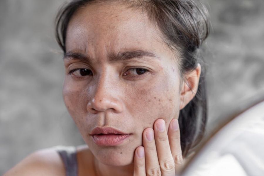 Ciri-ciri atau Tanda Alergi Kosmetik